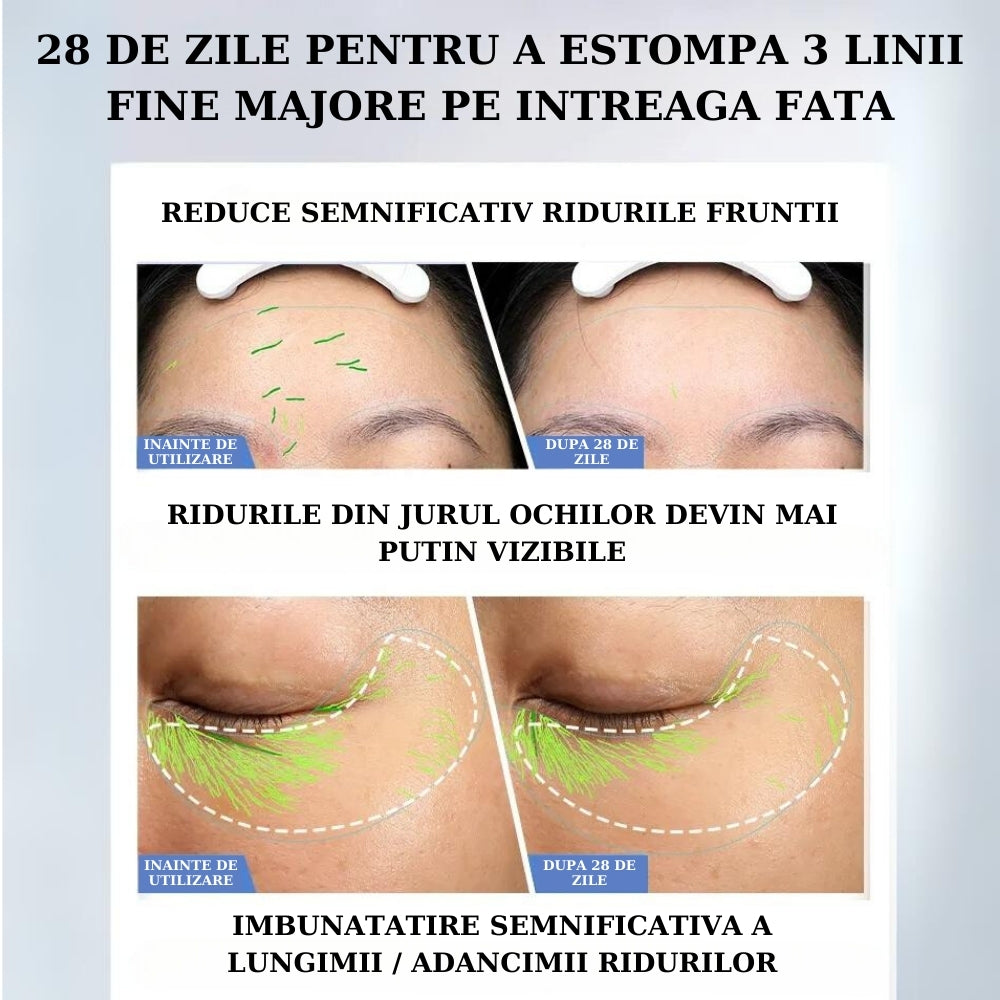 Aparat Antirid si Lifting Facial