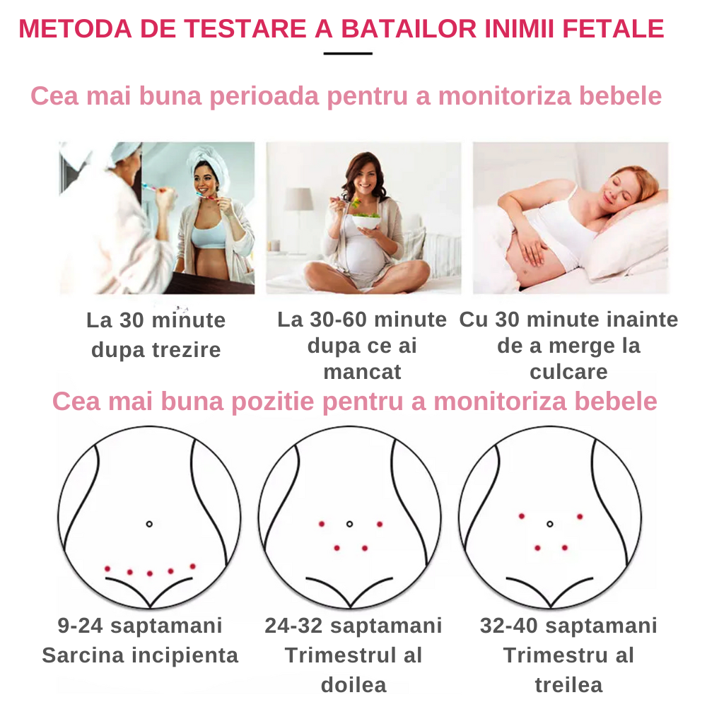 Monitor Doppler Fetal